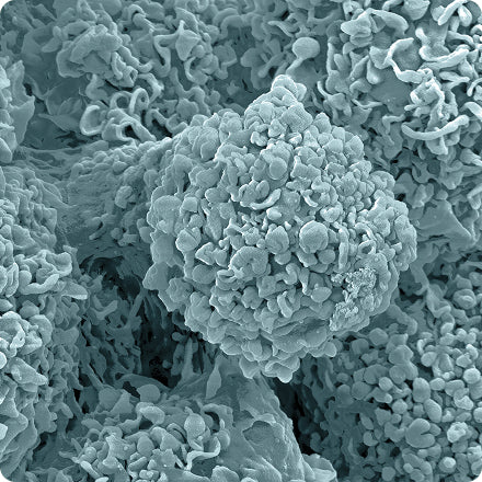 Electron Microscopy