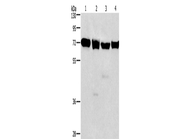 IL2RB Polyclonal Antibody Store at -20°C