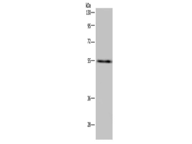 IMPDH2 Polyclonal Antibody Store at -20°C