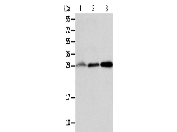 ALKBH2 Polyclonal Antibody Store at -20°C