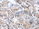 CAPZA2 Polyclonal Antibody
