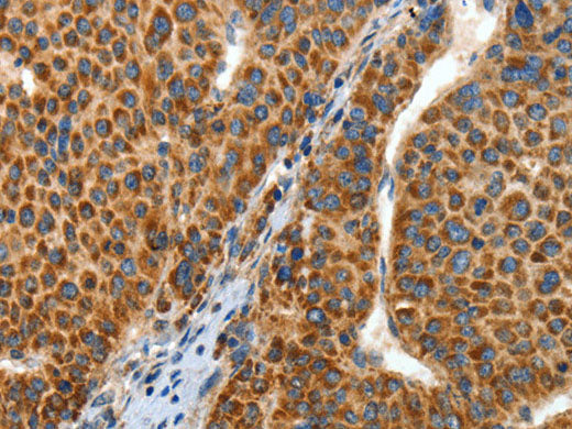 ANGPTL1 Polyclonal Antibody Store at -20°C