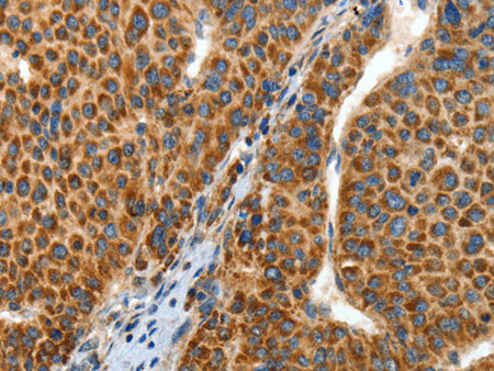 ANGPTL1 Polyclonal Antibody Store at -20°C