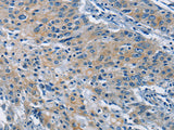 BMPR1B Polyclonal Antibody Store at -20°C