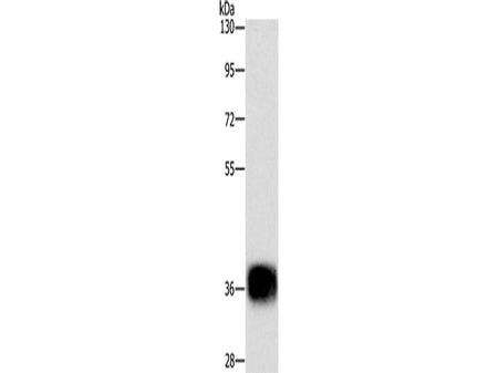 CEBP epsilon Polyclonal Antibody Store at -20°C