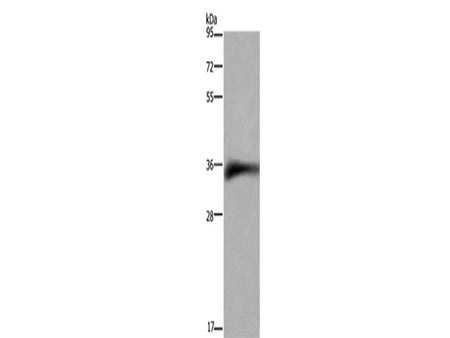 CD32 Polyclonal Antibody Store at -20°C