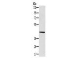 SCPEP1 Polyclonal Antibody