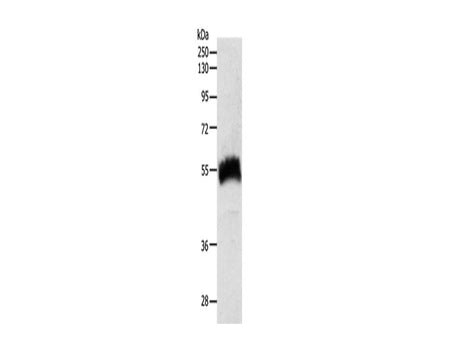 SLC22A6 Polyclonal Antibody