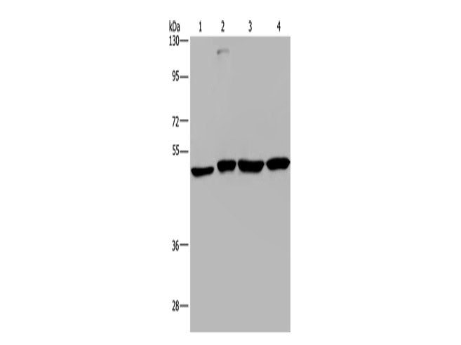 CCR6 Polyclonal Antibody Store at -20°C