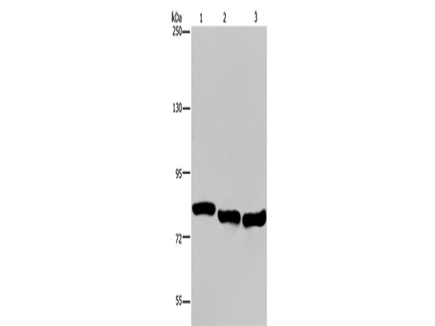 GAB2 Polyclonal Antibody Store at -20°C