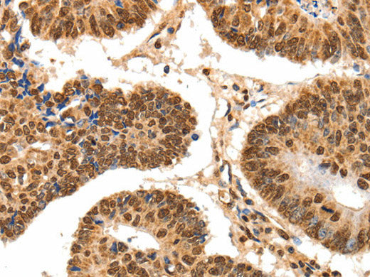 SPATA20 Polyclonal Antibody Store at -20°C