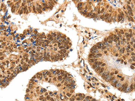 SPATA20 Polyclonal Antibody Store at -20°C