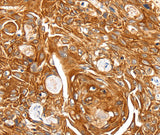 SFTPA1 Polyclonal Antibody