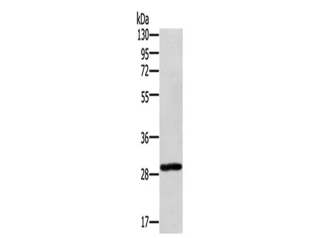 EDA2R Polyclonal Antibody Store at -20°C