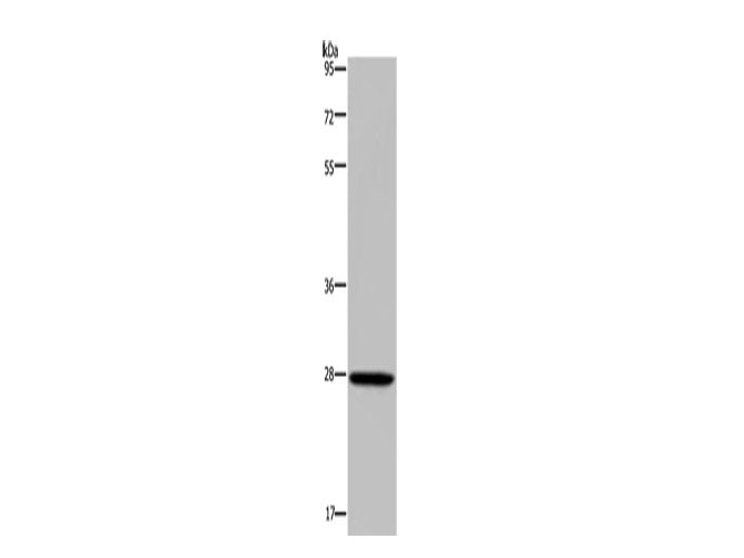 KLK14 Polyclonal Antibody Store at -20°C