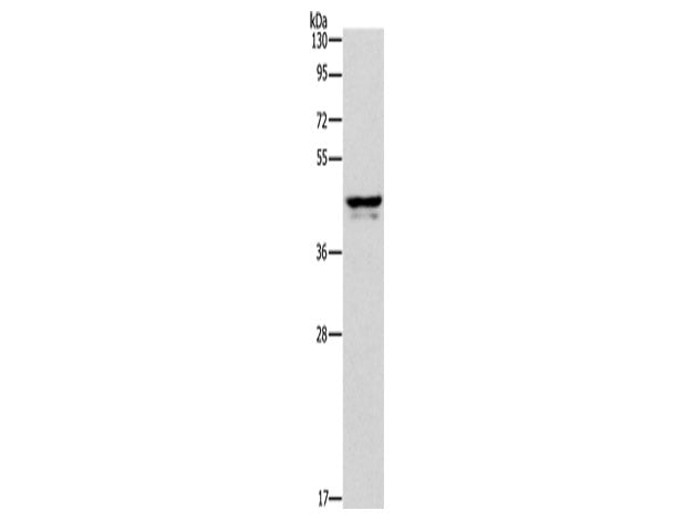 APOL1 Polyclonal Antibody Store at -20°C