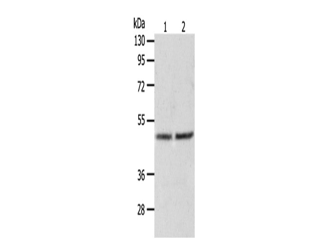 AGXT Polyclonal Antibody Store at -20°C