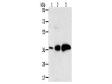 AKR1C1 Polyclonal Antibody Store at -20°C