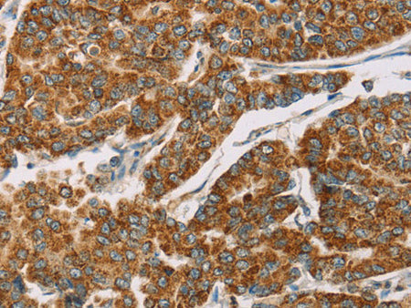 DLL4 Polyclonal Antibody Store at -20°C