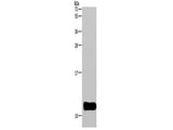 DYNLL1 Polyclonal Antibody Store at -20°C