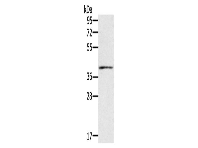IFNGR2 Polyclonal Antibody Store at -20°C