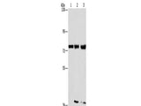 GGCX Polyclonal Antibody Store at -20°C