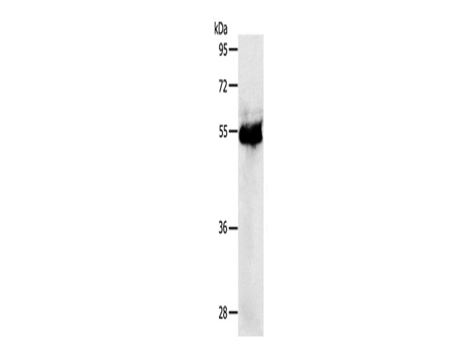 PRKAR1B Polyclonal Antibody Store at -20°C