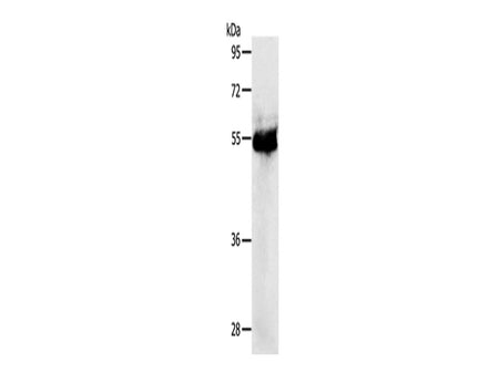 PRKAR1B Polyclonal Antibody Store at -20°C