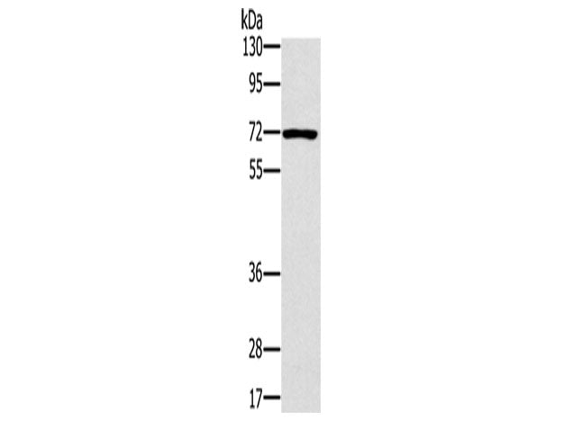PLS3 Polyclonal Antibody Store at -20°C