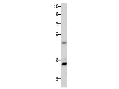 MC1R Polyclonal Antibody Store at -20°C