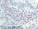CD272 Polyclonal Antibody Store at -20°C