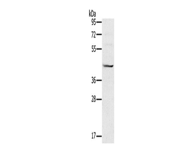 MVK Polyclonal Antibody