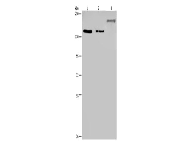 KDM3B Polyclonal Antibody Store at -20°C