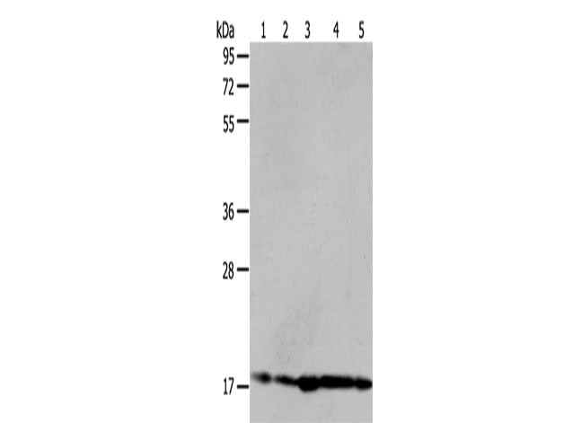 ARF6 Polyclonal Antibody Store at -20°C