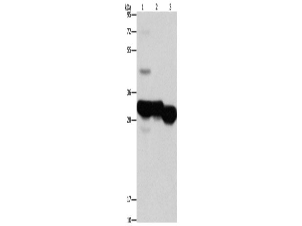 KHK Polyclonal Antibody Store at -20°C