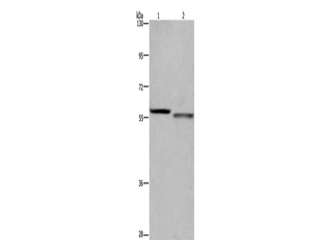 FRK Polyclonal Antibody Store at -20°C