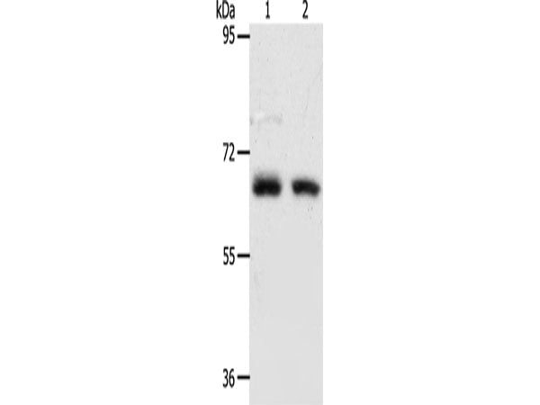 ACOT11 Polyclonal Antibody Store at -20°C
