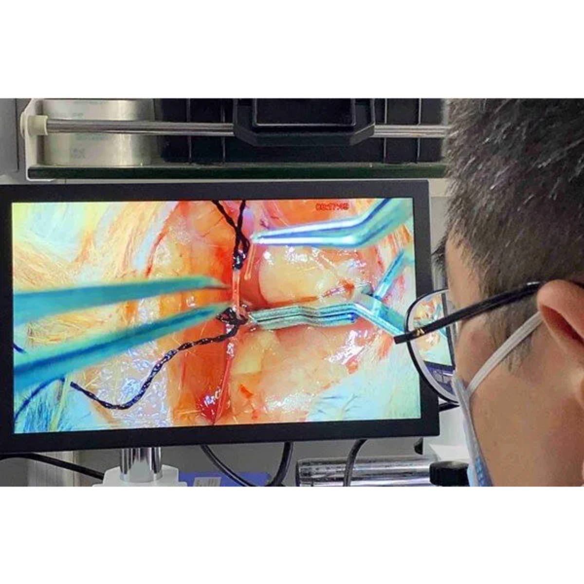 RWD Digital Microscope