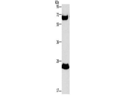 GGT1 Polyclonal Antibody Store at -20°C