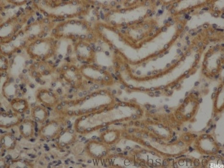 AFP Polyclonal Antibody, Biomarkers, Elabscience Biotechnology, MSE Supplies