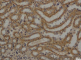 AFP Polyclonal Antibody, Biomarkers, Elabscience Biotechnology, MSE Supplies
