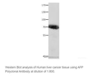 AFP Polyclonal Antibody - MSE Supplies LLC