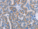 FN1 Polyclonal Antibody Store at -20°C