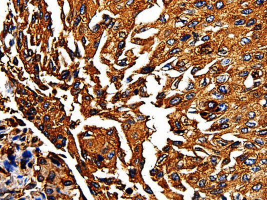 PKM Polyclonal Antibody Store at -20°C