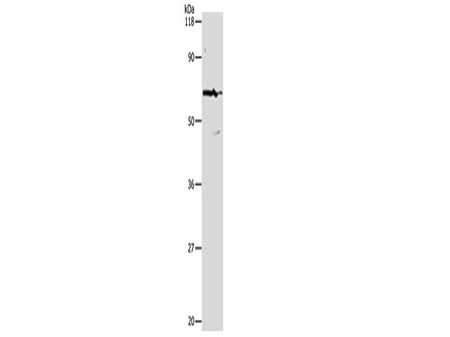 PKM Polyclonal Antibody Store at -20°C