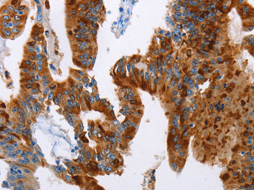 TFF3 Polyclonal Antibody
