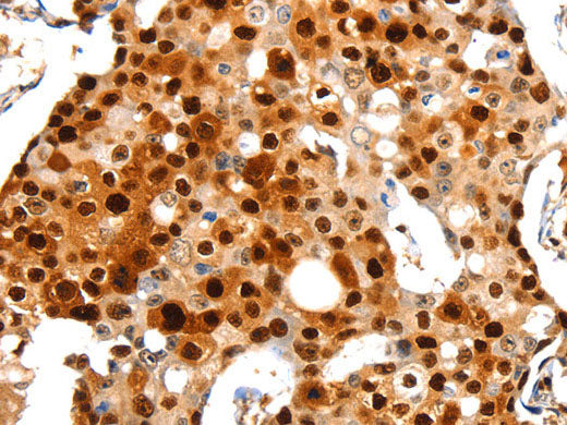 PCNA Polyclonal Antibody Store at -20°C
