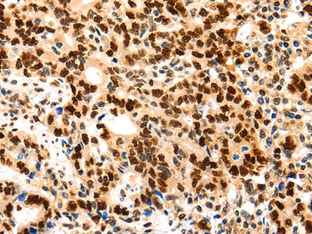 PCNA Polyclonal Antibody Store at -20°C