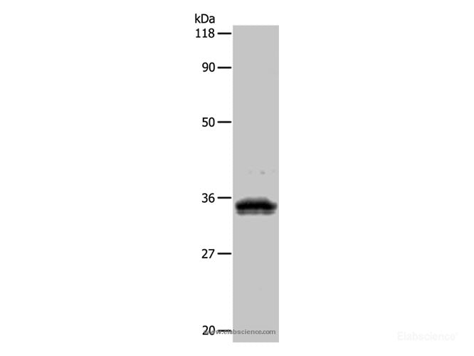 UPK3B Polyclonal Antibody Store at -20°C