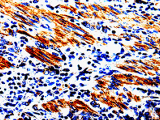 ACSBG2 Polyclonal Antibody Store at -20°C